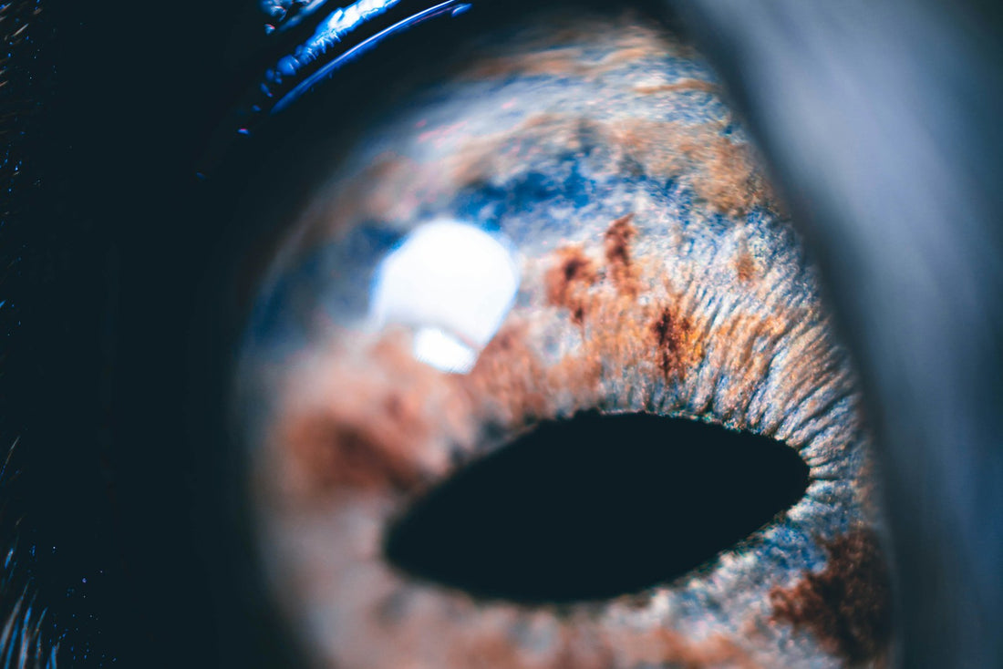 Close-up of a dog's watery inner eye corner, a common sign of a blocked tear duct in dogs uk
